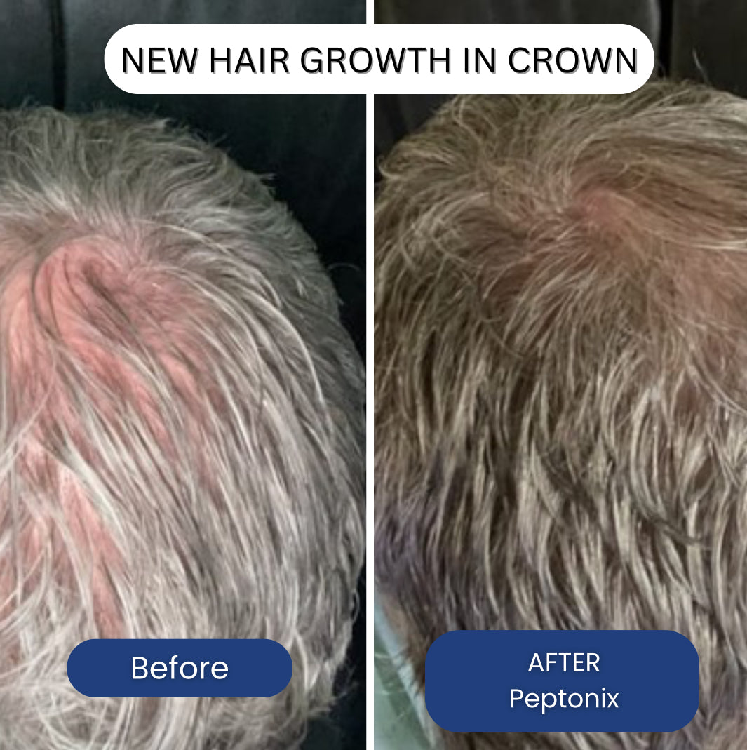 Copper Peptide Hair Regrowth Formula By Peptonix