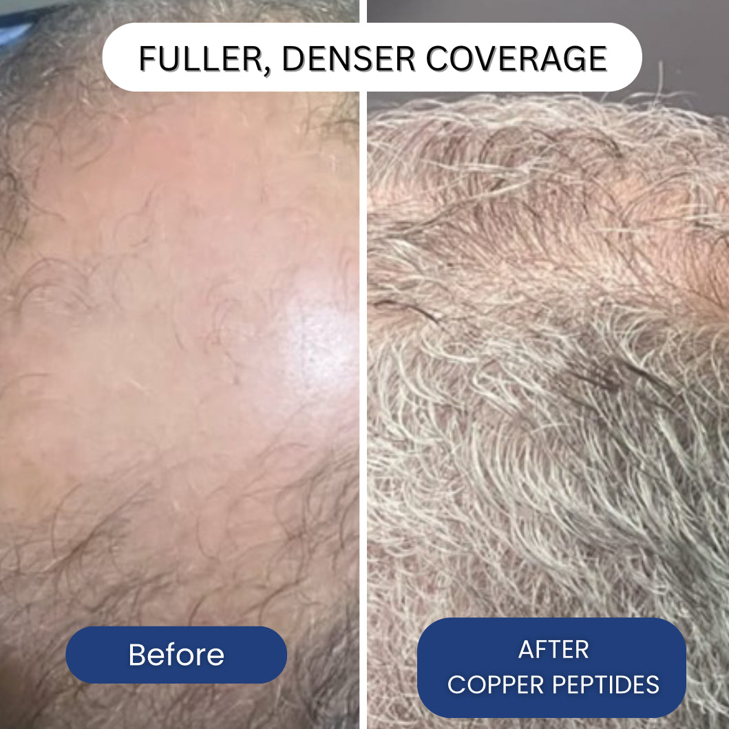 Copper Peptide Hair Regrowth Formula By Peptonix